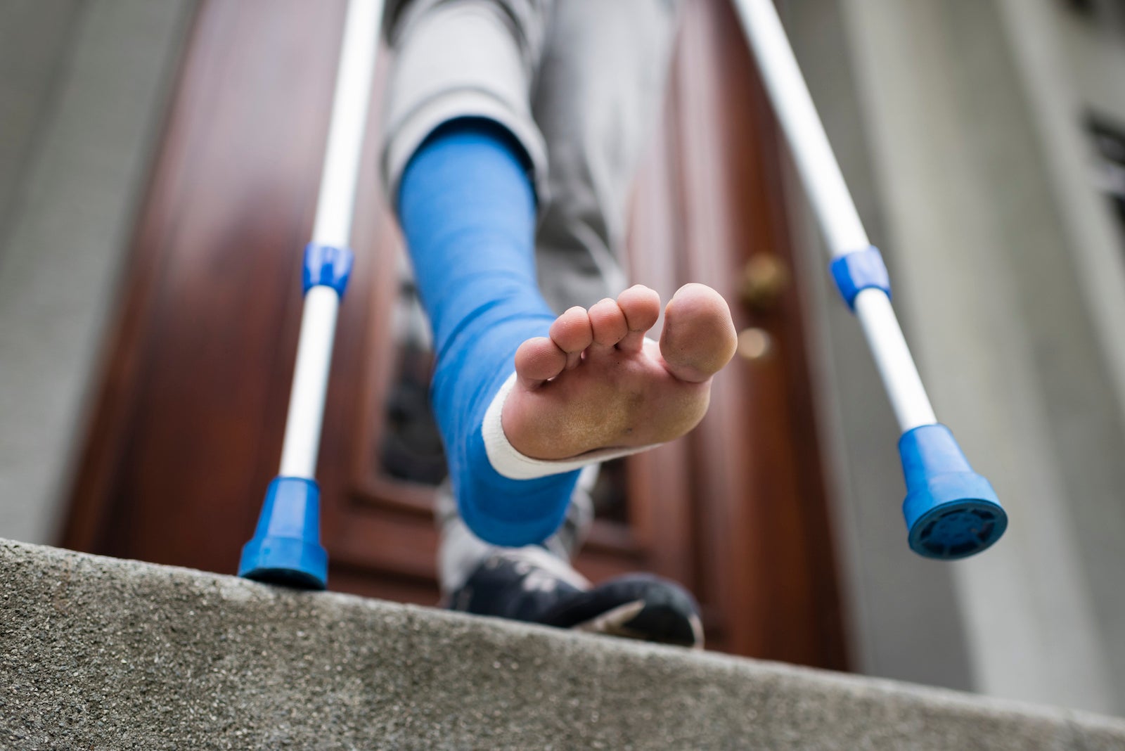 An image of a person with an injured leg